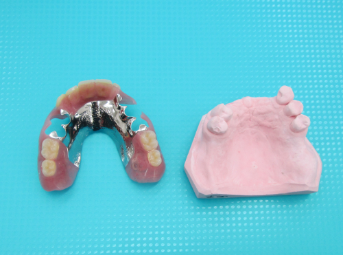 小臼歯部残存症例