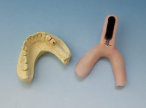 歯科印象用個人トレー