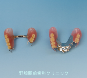 保険の義歯との比較・上顎