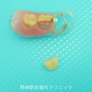 人工歯の破折